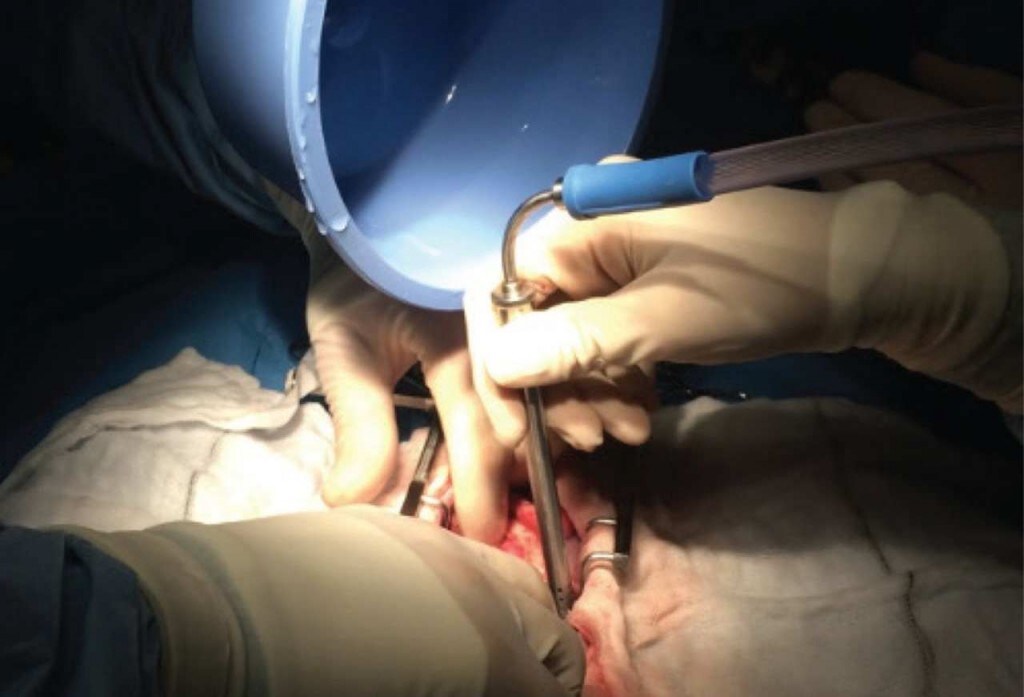 Heat pipes useful in brain surgery were originally developed at NASA. Image: NASA
