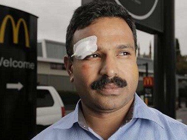 Limax Joy was allegedly subjected to a racial attack in Australia. Source: News18