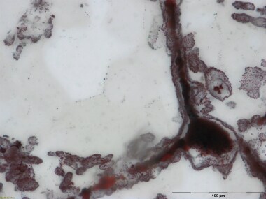 Microscope image shows a filament attached to a clump of iron at lower right in rock found in Quebec, Canada. AP