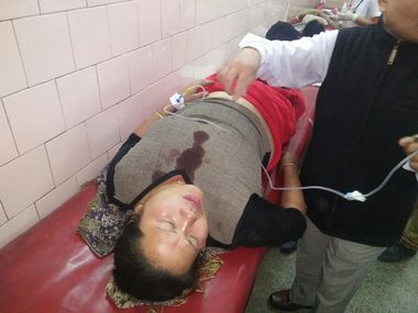 Manipur Election 2017: 6 injured in Imphal IED blast Manipur Election 2017: 6 injured in Imphal IED blast