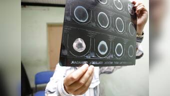 Mental Healthcare Bill: Despite the positive reform, a lot more needs to be done for the mentally ill