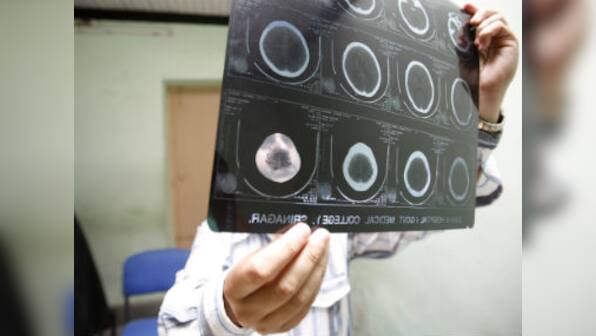Mental Healthcare Bill: Despite the positive reform, a lot more needs to be done for the mentally ill