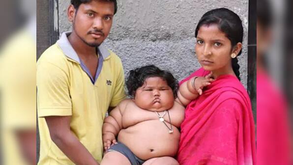 Watch: Eight-month-old-baby weighing 17 kg baffles doctors