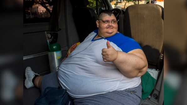 Juan Pedro Franco, world's heaviest man goes under knife in Mexico