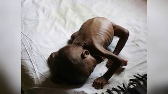 Kerala announces aid to parents of 38 tribal children who died due to malnutrition