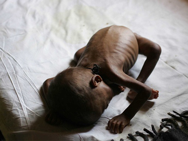 Kerala announces aid to parents of 38 tribal children who died due to malnutrition Kerala announces aid to parents of 38 tribal children who died due to malnutrition