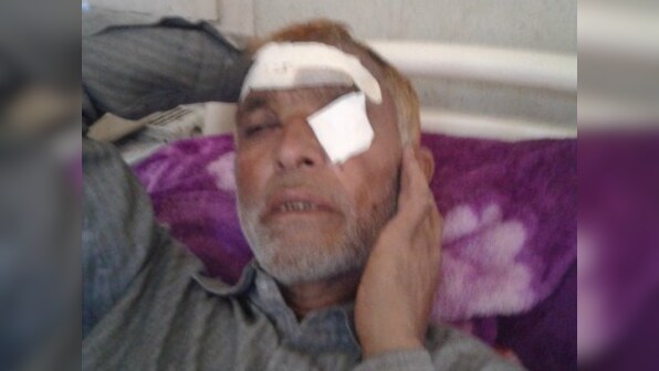 Kashmir unrest: Pellet injuries pile up as clashes over death of Hizbul commander Sabzar Bhat continue