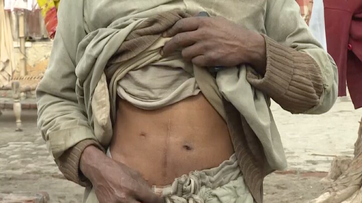 Watch: Wealth and Poverty keep Pakistan's Illegal Organ Trafficking Trade alive
