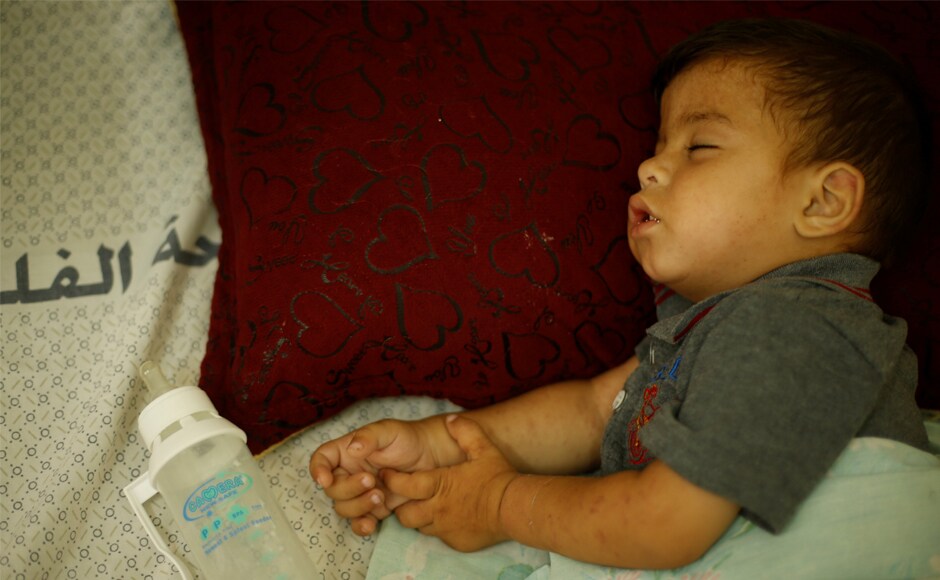 Ahmed Abbas, who suffers from cystic fibrosis, sleeps as he lies on a hospital bed in Gaza City. According to WHO, increasing power cuts and fuel shortages are creating an impending health crisis for Gaza’s 14 public hospitals, threatening the closure of essential health services which would leave thousands of people without access to life-saving health care. Reuters Ahmed Abbas, who suffers from cystic fibrosis, sleeps as he lies on a hospital bed in Gaza City. According to WHO, increasing power cuts and fuel shortages are creating an impending health crisis for Gaza’s 14 public hospitals, threatening the closure of essential health services which would leave thousands of people without access to life-saving health care. Reuters