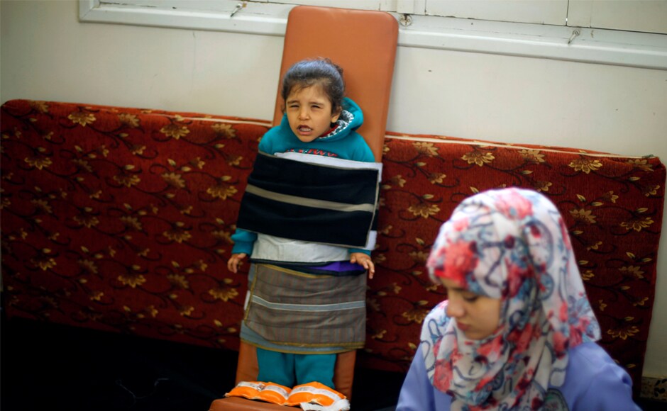 Palestinian girl Rasha al-Bayed, 5, who suffers from cerebral palsy, attends a physiotherapy session at Mabaret Falasteen charity in Gaza City. Without fuel, 40 surgical operation theatres, 11 obstetric operation theatres, 5 haemodialysis centres and hospital emergency departments serving almost 4,000 patients daily will be forced to stop critical services. Reuters Palestinian girl Rasha al-Bayed, 5, who suffers from cerebral palsy, attends a physiotherapy session at Mabaret Falasteen charity in Gaza City. Without fuel, 40 surgical operation theatres, 11 obstetric operation theatres, 5 haemodialysis centres and hospital emergency departments serving almost 4,000 patients daily will be forced to stop critical services. Reuters