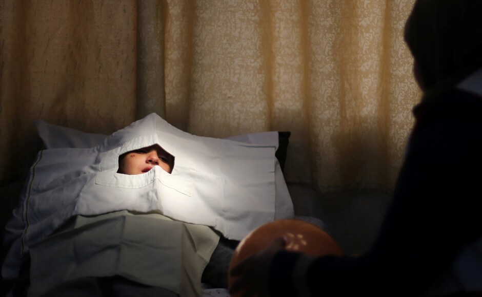 Palestinian girl Jana Al-Bodi, 5, lies on a bed before nurses remove stitches over her eye at Al Awda Hospital, a private medical facility in the northern Gaza Strip. The spokesman for Gaza's Hamas-run health ministry, Ashraf Al-Qidra, said PA shipments of medicine, especially drugs to treat cancer and cystic fibrosis, have dropped 35 percent since late March. Reuters Palestinian girl Jana Al-Bodi, 5, lies on a bed before nurses remove stitches over her eye at Al Awda Hospital, a private medical facility in the northern Gaza Strip. The spokesman for Gaza's Hamas-run health ministry, Ashraf Al-Qidra, said PA shipments of medicine, especially drugs to treat cancer and cystic fibrosis, have dropped 35 percent since late March. Reuters