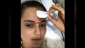 Kangana Ranaut won't walk the ramp at India Couture week due to injury on Manikarnika set