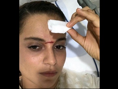Kangana Ranaut won't walk the ramp at India Couture week due to injury on Manikarnika set Kangana Ranaut won't walk the ramp at India Couture week due to injury on Manikarnika set