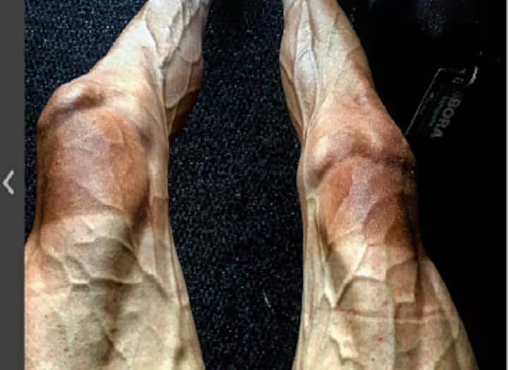 Tour de France 2017: Cyclist Pawel Poljanski's vein-popping legs send social media into frenzy