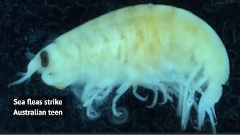 Sea fleas, the mysterious sea creatures that left Australian teenager's feet bloody?