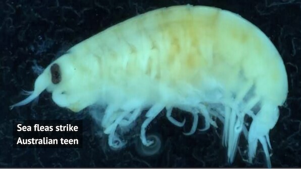 Sea fleas, the mysterious sea creatures that left Australian teenager's feet bloody?