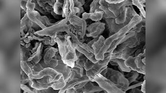 Nanodiamonds in lithium batteries can prevent short circuits and fires in smartphones and laptops: Study