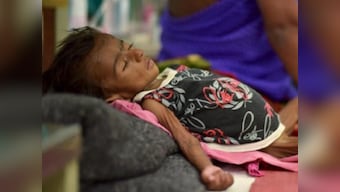 Jharkhand health crisis: In Jamshedpur, 52 infants die from malnutrition in 30 days