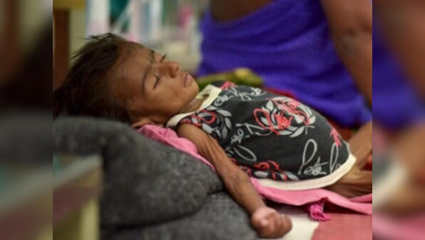 Jharkhand health crisis: In Jamshedpur, 52 infants die from malnutrition in 30 days