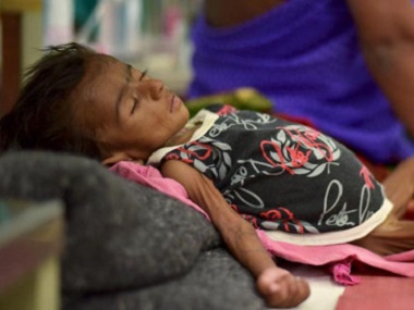 Jharkhand health crisis: In Jamshedpur, 52 infants die from malnutrition in 30 days Jharkhand health crisis: In Jamshedpur, 52 infants die from malnutrition in 30 days