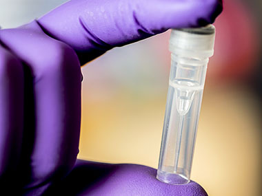 Researchers remotely compromise a computer using malicious code hidden in synthetic DNA Researchers remotely compromise a computer using malicious code hidden in synthetic DNA