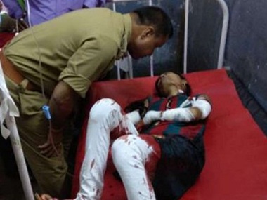 BHU unrest: After police lathicharge, many circulate fake image of injured girl not related to incident BHU unrest: After police lathicharge, many circulate fake image of injured girl not related to incident