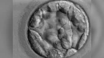 CRISPR gene editing technique sheds light on key gene for human embryo development