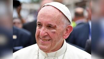 No divine intervention: Pope Francis bangs head on popemobile, gets black eye as he wraps up Colombia trip