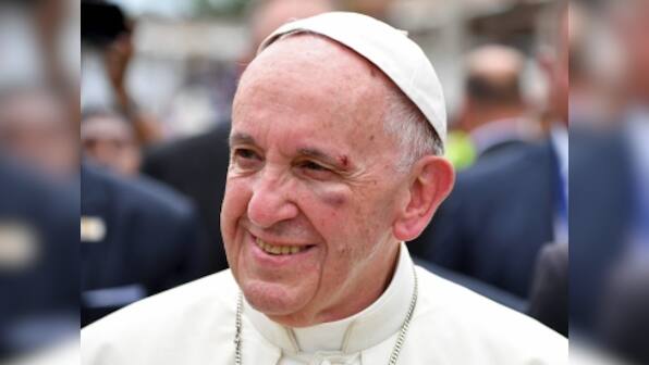 No divine intervention: Pope Francis bangs head on popemobile, gets black eye as he wraps up Colombia trip