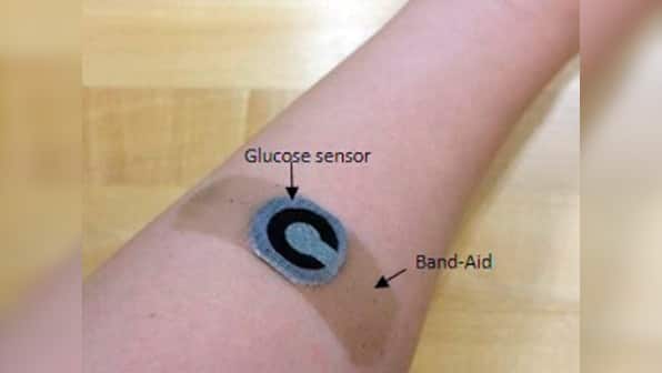 Researchers develop paper based wearable sensor that allows diabetics to measure glucose levels from sweat