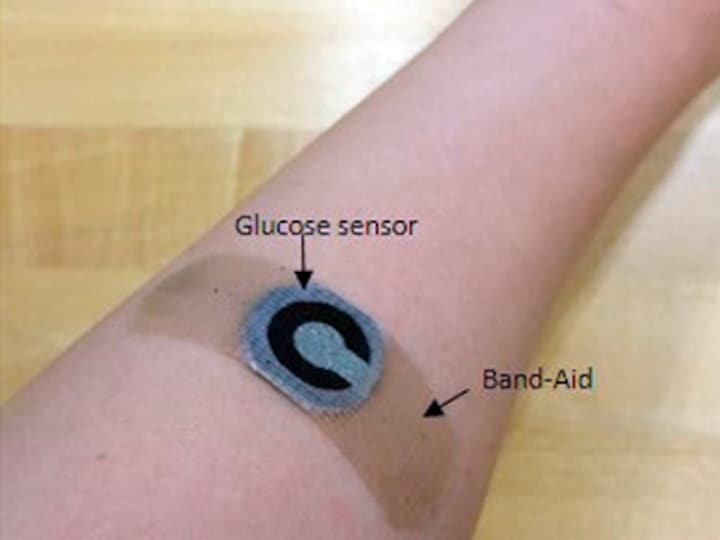 Researchers develop paper based wearable sensor that allows diabetics to measure glucose levels from sweat
