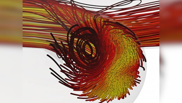 Researchers use AI to design a device that can improve dialysis by optimising blood flow