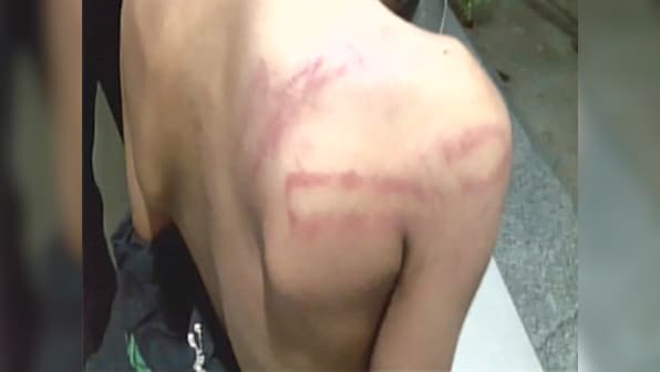 Hyderabad teacher beats up 5-year-old UKG student with stick at school; boy hospitalised