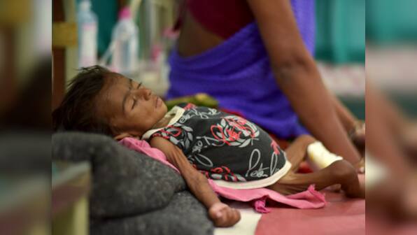 India improved its infant mortality rate, yet has highest number of malnourished children in the world: Report