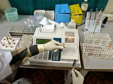 Laboratory assistant examines blood samples inside laboratory in Siliguri, West Bengal. Image: Reuters