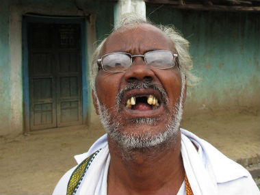 Marathwada Diary: High amounts of fluoride in groundwater continue to threaten drought-hit Nanded villages Marathwada Diary: High amounts of fluoride in groundwater continue to threaten drought-hit Nanded villages