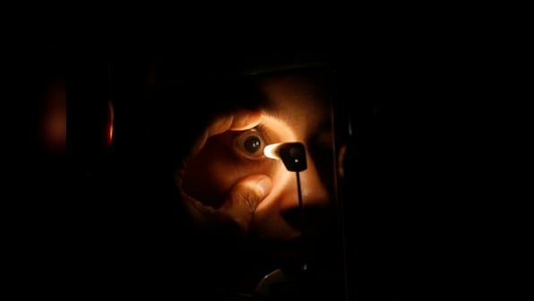 Chhattisgarh: 11 people lose vision in one eye after botched-up cataract surgery in Rajnandgaon