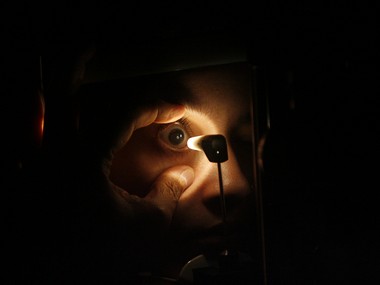 Chhattisgarh: 11 people lose vision in one eye after botched-up cataract surgery in Rajnandgaon Chhattisgarh: 11 people lose vision in one eye after botched-up cataract surgery in Rajnandgaon