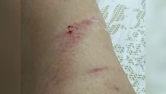 Indore model sexually harassed while riding scooter; motorbike-borne men pulled her skirt, asked 'what's under it?'