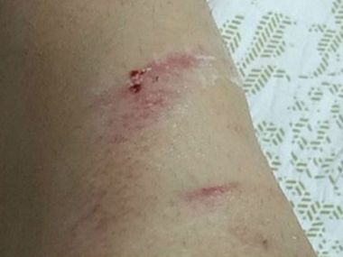 Indore model sexually harassed while riding scooter; motorbike-borne men pulled her skirt, asked 'what's under it?' Indore model sexually harassed while riding scooter; motorbike-borne men pulled her skirt, asked 'what's under it?'