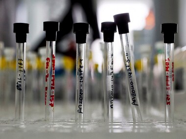 cancer. Representationa Image. Reuters