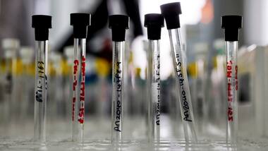 Indian scientists put mathematics to work in treating cancer more effectively