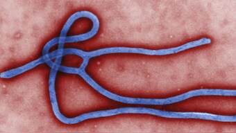 Ebola: How Gabon built an ultra-secure facility to study world's deadliest viruses