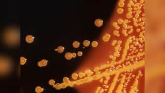 E Coli outbreak: 5 dead in the US, romaine lettuce from Arizona likely to be the cause