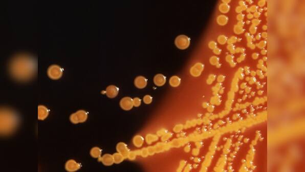 E Coli outbreak: 5 dead in the US, romaine lettuce from Arizona likely to be the cause