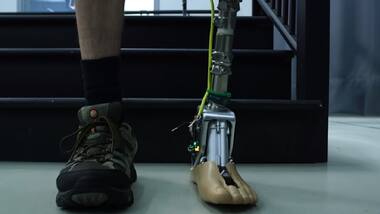 This smart prosthetic ankle is as close as it gets to the real thing