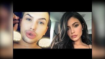 Kylie Jenner's fan tries imitating her pout, excessive fillers spill out of lips