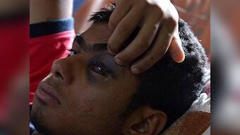 Under PDP-BJP rule, Kashmir saw 74 percent more people certified 'disabled'; pellet guns behind rise in numbers