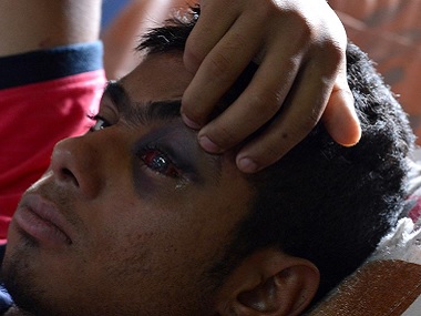 Under PDP-BJP rule, Kashmir saw 74 percent more people certified 'disabled'; pellet guns behind rise in numbers Under PDP-BJP rule, Kashmir saw 74 percent more people certified 'disabled'; pellet guns behind rise in numbers