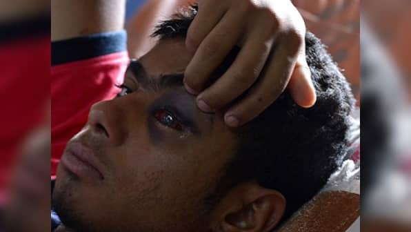 Under PDP-BJP rule, Kashmir saw 74 percent more people certified 'disabled'; pellet guns behind rise in numbers